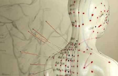 Acupuncture and Oriental Medicine Major